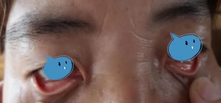 许家栋经典经方医案,许家栋经典经方治脾胃病