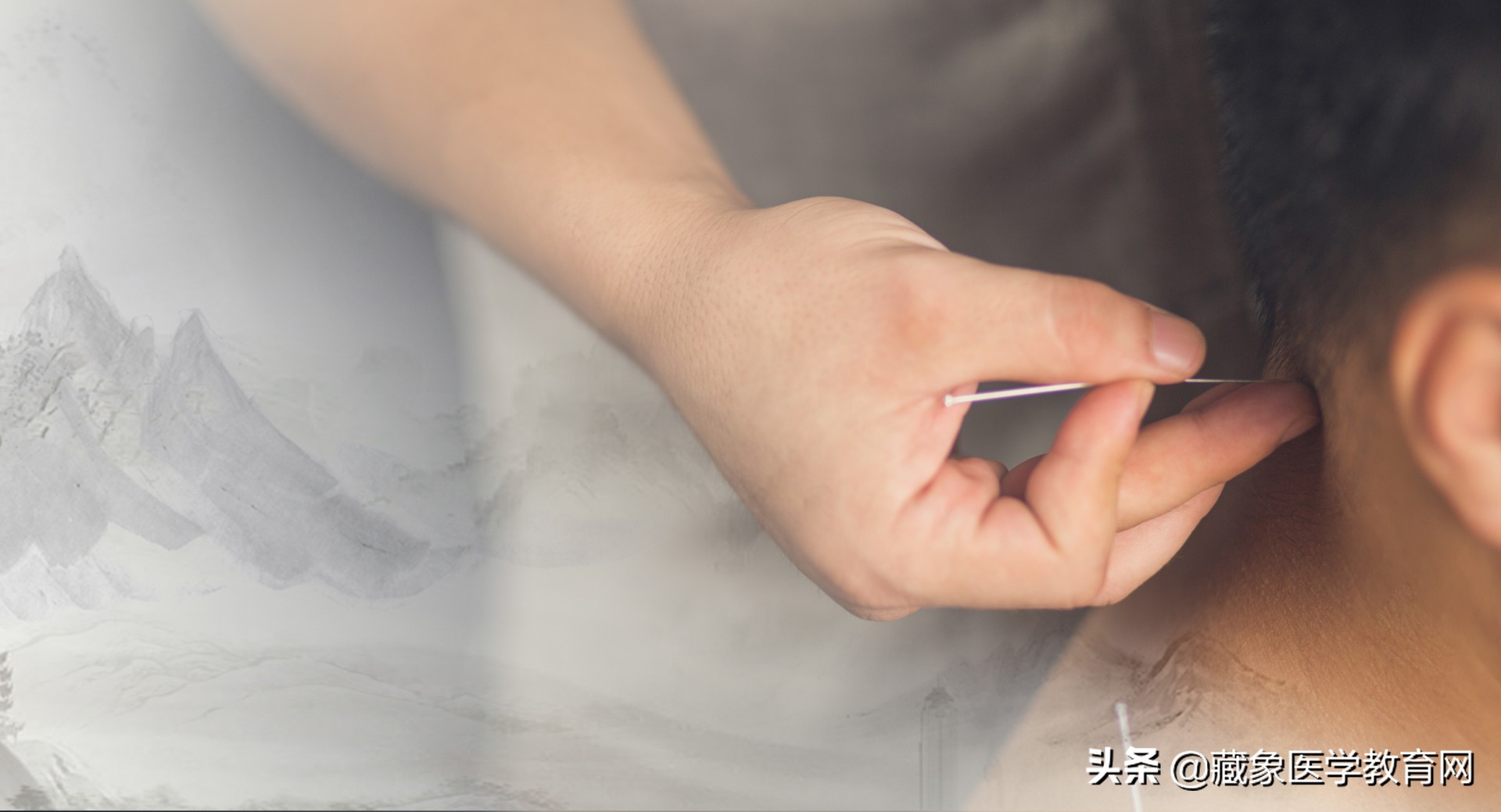 海外针灸,中医针灸真的那么神奇吗