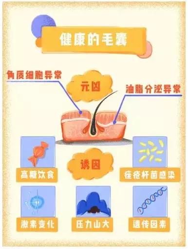 痘印痘坑痘痕去医院可以治好吗,防止痘坑的最好方法