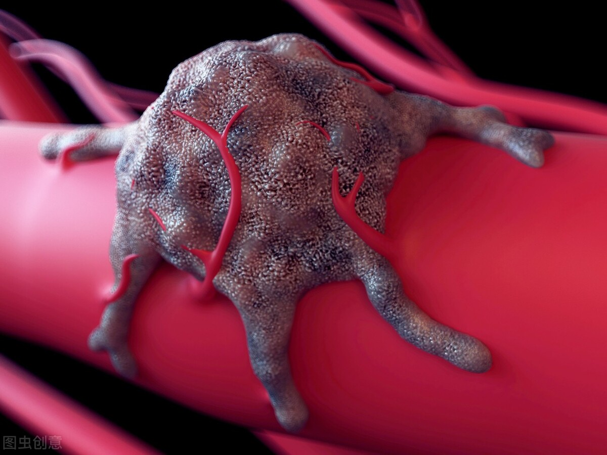 乳腺纤维瘤的症状和危害,青少年乳腺纤维瘤症状怎么治疗