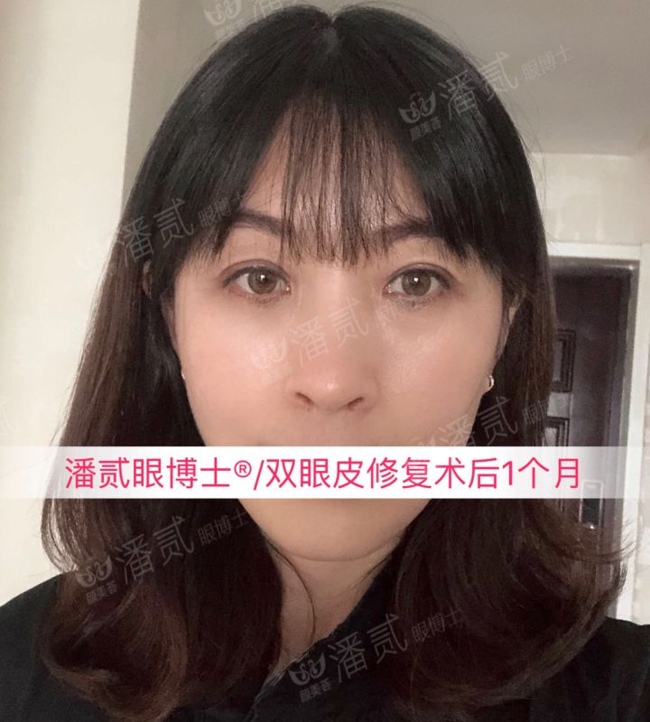 割了开扇双眼皮眼尾上扬太宽,眼尾上扬的眼睛适合什么双眼皮