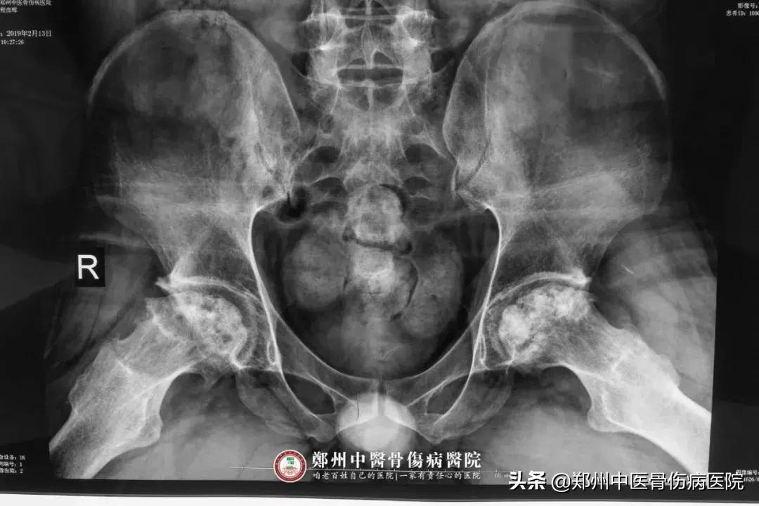 求医之路再艰难也要勇敢面对,八年求医