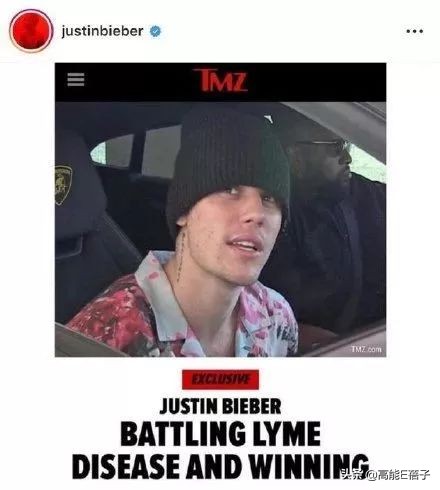 贾斯汀比伯浪了一圈归来还是少年,贾斯汀比伯晒自曝右脸面瘫