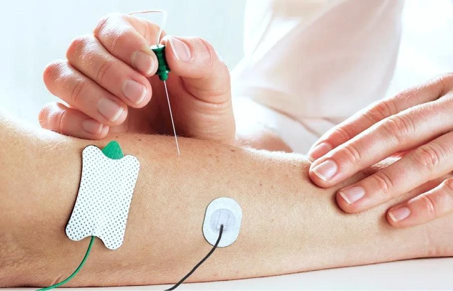 上肢肌电图检查视频,上肢的肌电图检查怎么查