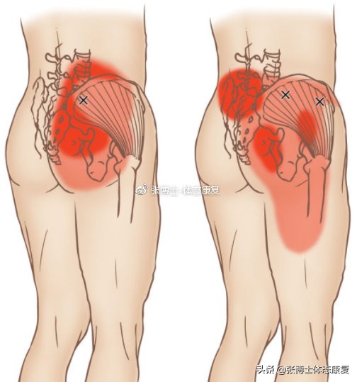 功能训练臀多久练一次,功能性训练臀与下肢训练动作