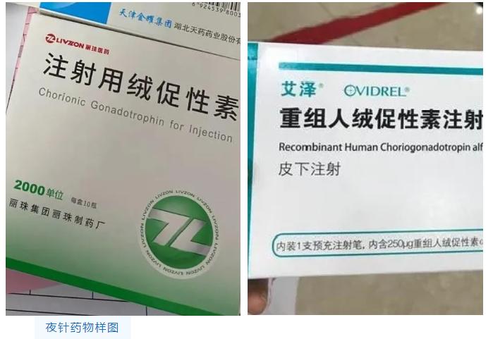 试管打着床针,试管需要针灸助孕吗