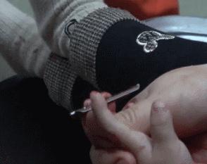 小朋友手指被夹流血,漯河1岁女童手指被夹断