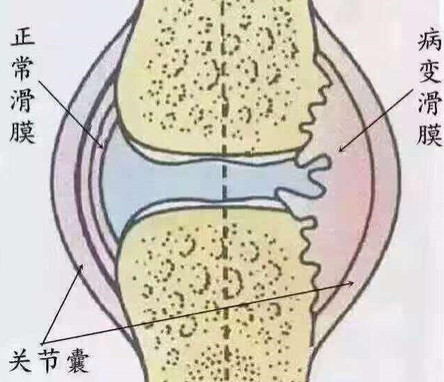一吹空调就关节痛,吹空调胳膊关节疼痛怎么解决