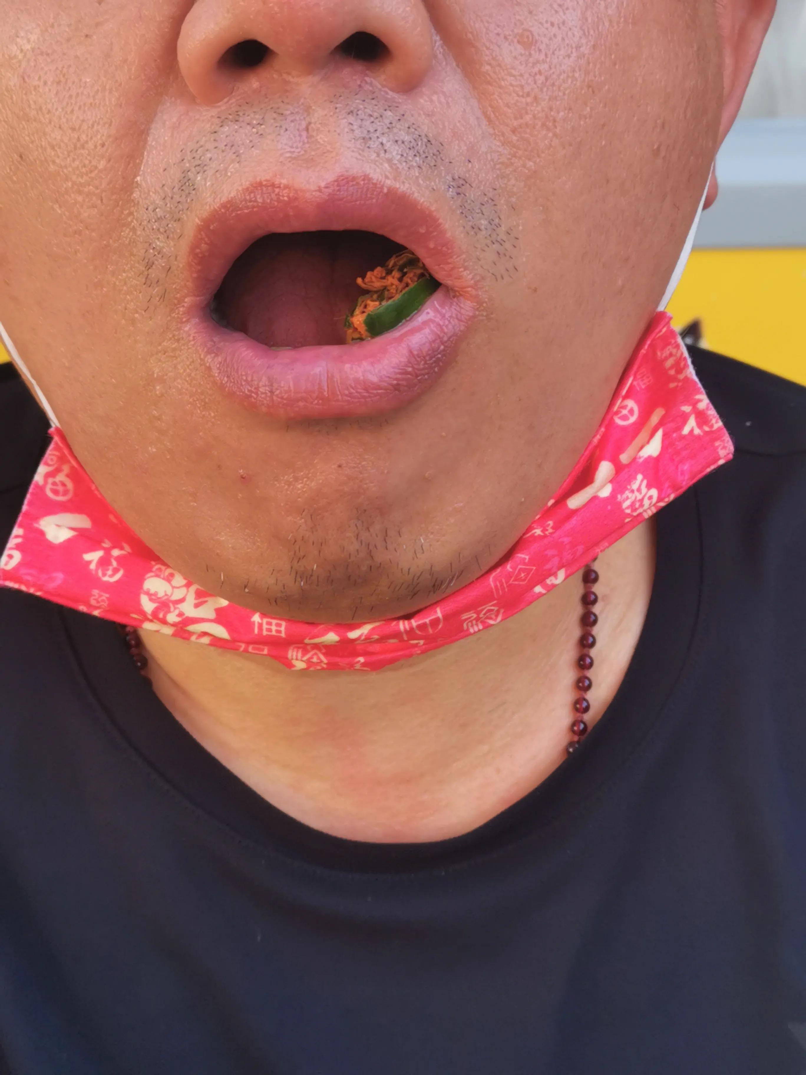 吃槟榔之后不能吃什么,吃槟榔之后的样子