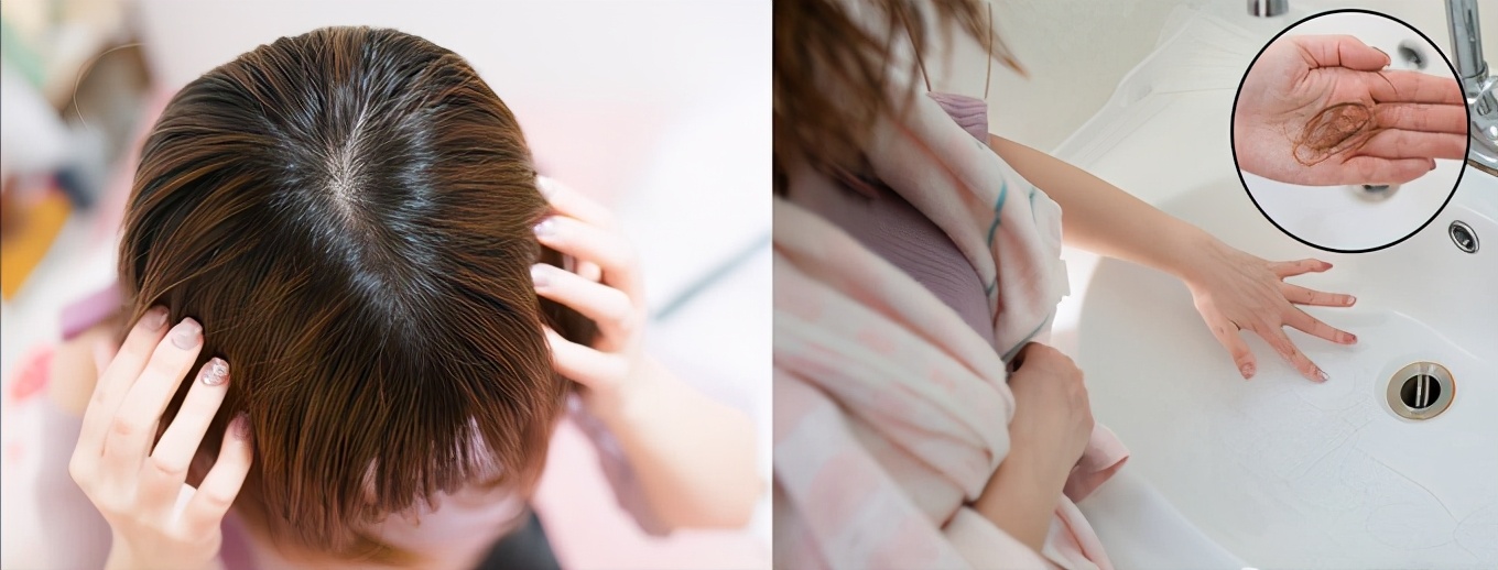 目前防脱固发口碑最好洗发水,真正的防脱固发洗发水