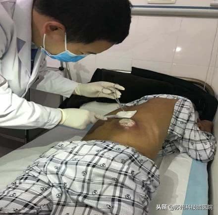 扎根山区医务人员讲述,扎根山区的医护人员