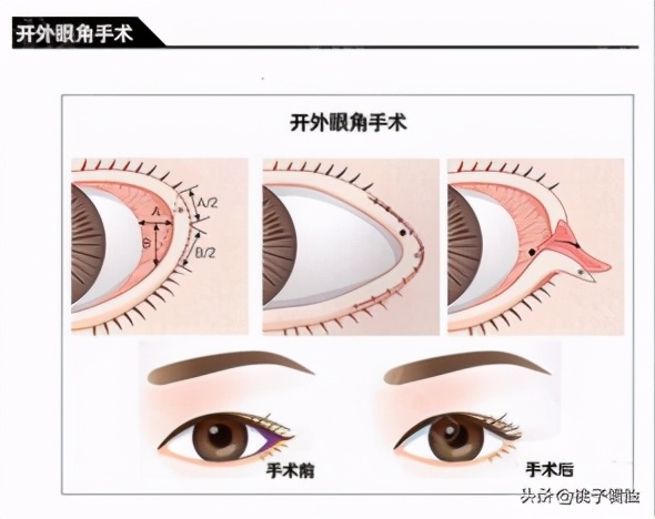 为什么面无表情老被别人认为生气,面无表情老是被人说在生气