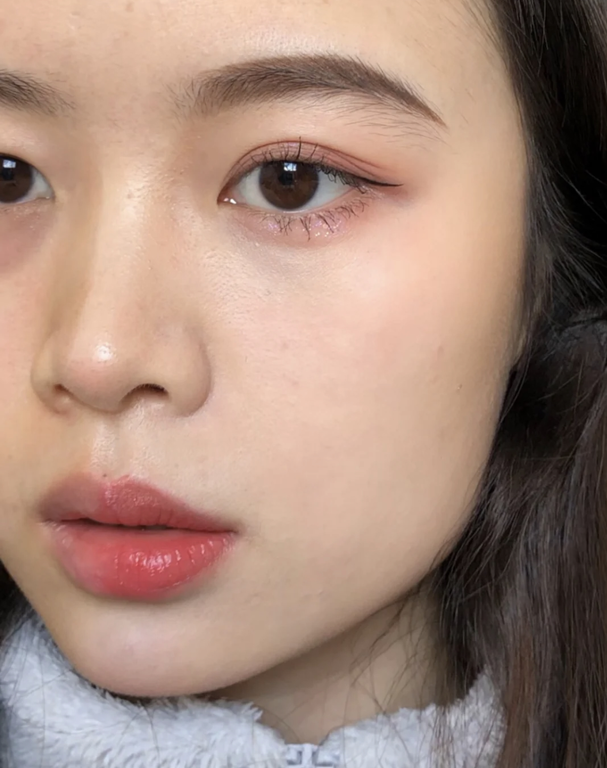 眼尾有皱纹怎么治疗,眼尾沟里面有皱纹怎么办