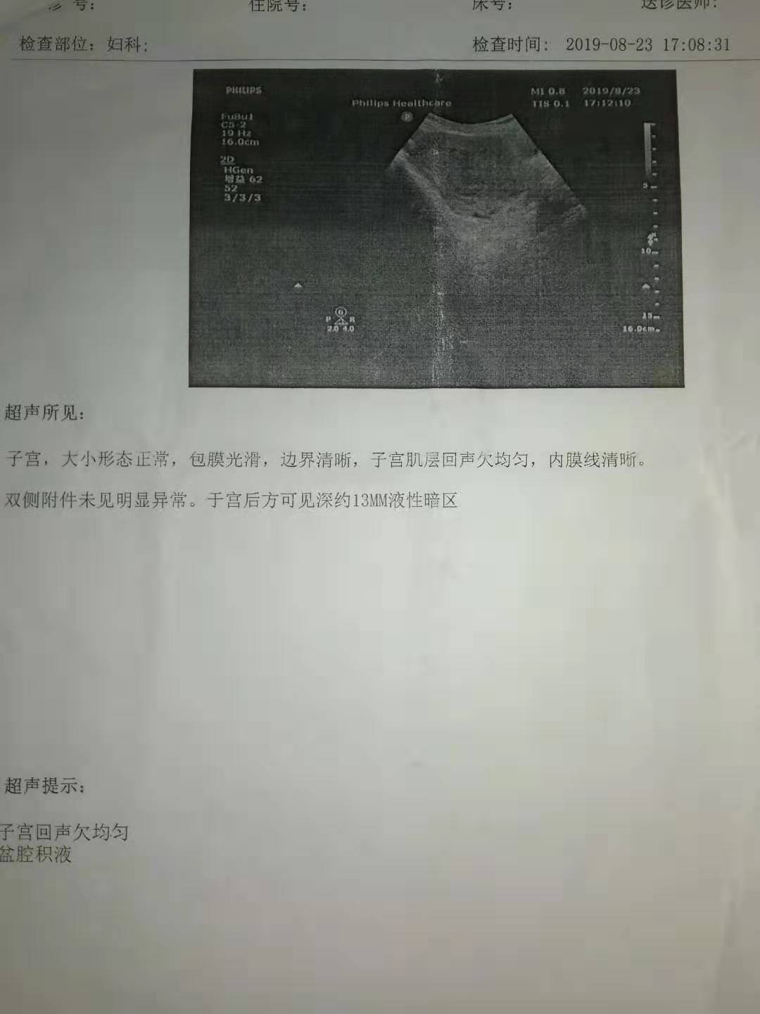 关于盆腔积液治疗,关于盆景的销售