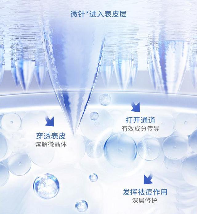 珂语祛痘凝胶直播,祛痘精华珂语