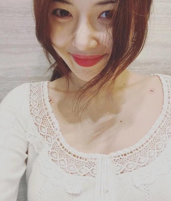 泫雅锁骨埋钉,泫雅晒打锁骨钉