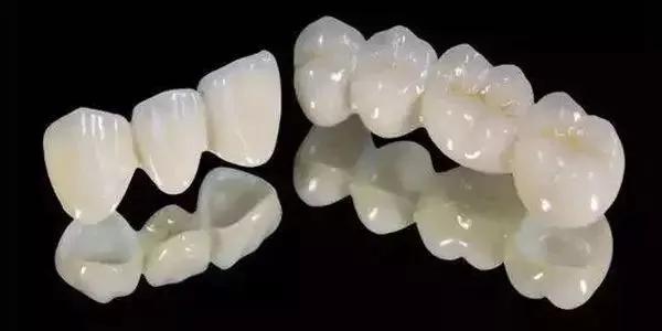 做了种植牙能做核磁共振吗,种植牙后可以做核磁共振检查吗