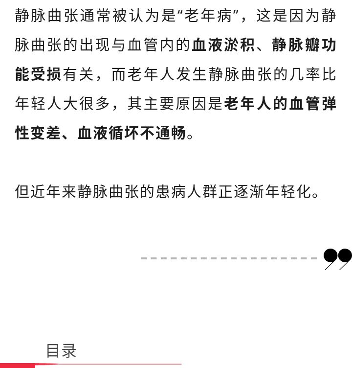 静脉曲张你了解多少,静脉曲张怎么治最好