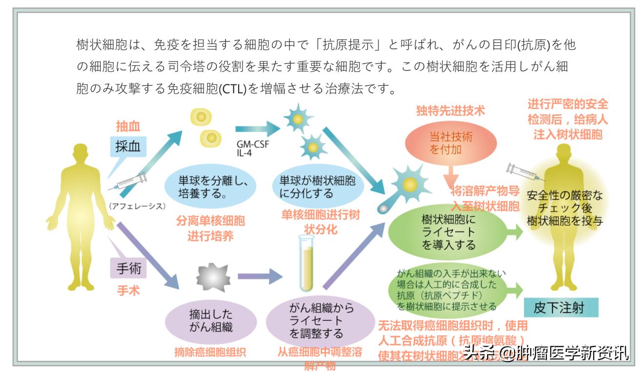 日本发明抗癌药免疫疗法,日本最新免疫治疗癌细胞