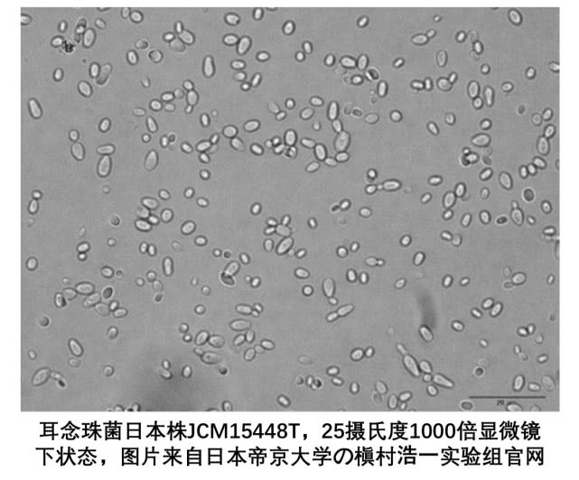 闻臭袜子真会导致真菌感染吗,闻臭袜子会真菌感染导致发烧吗