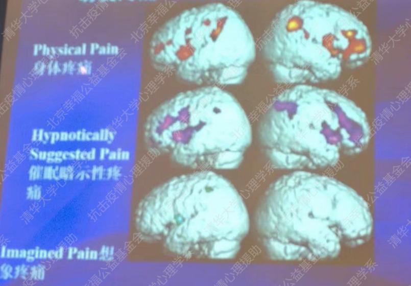 催眠治疗在心理咨询中的应用,心理治疗里的催眠有什么作用