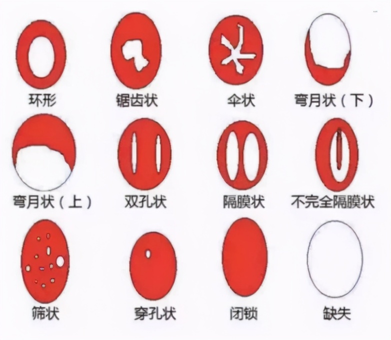 处女膜,其实并不是膜