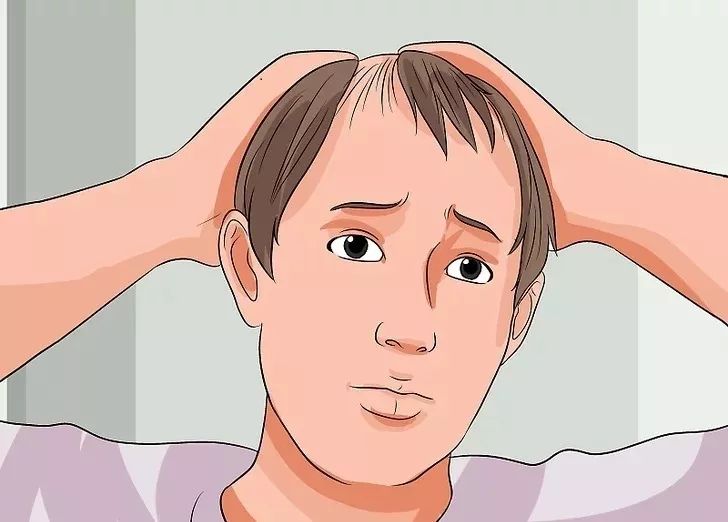 锻炼治斑秃,运动斑秃