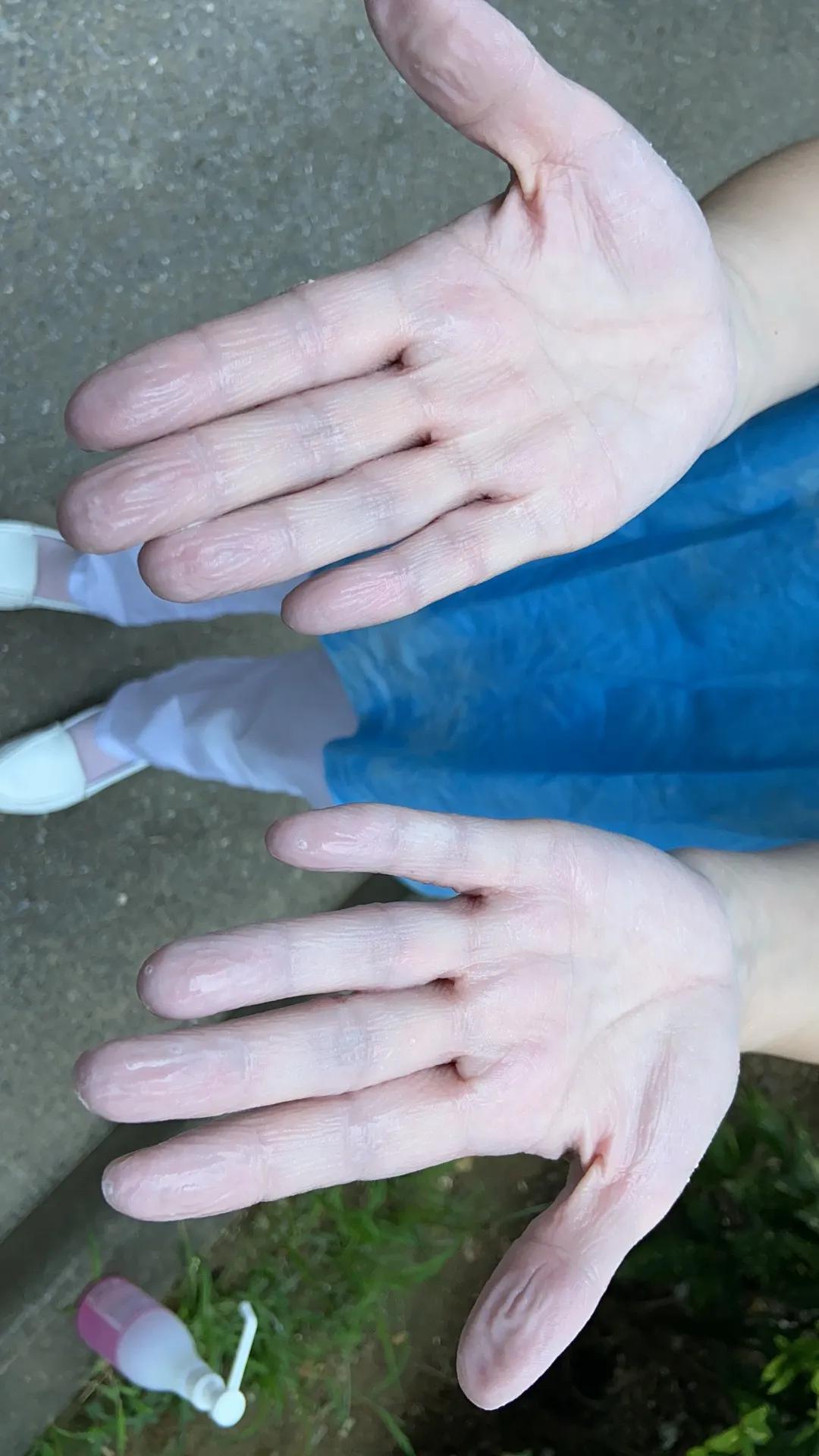 驰援抗疫情,扬州南京疫情