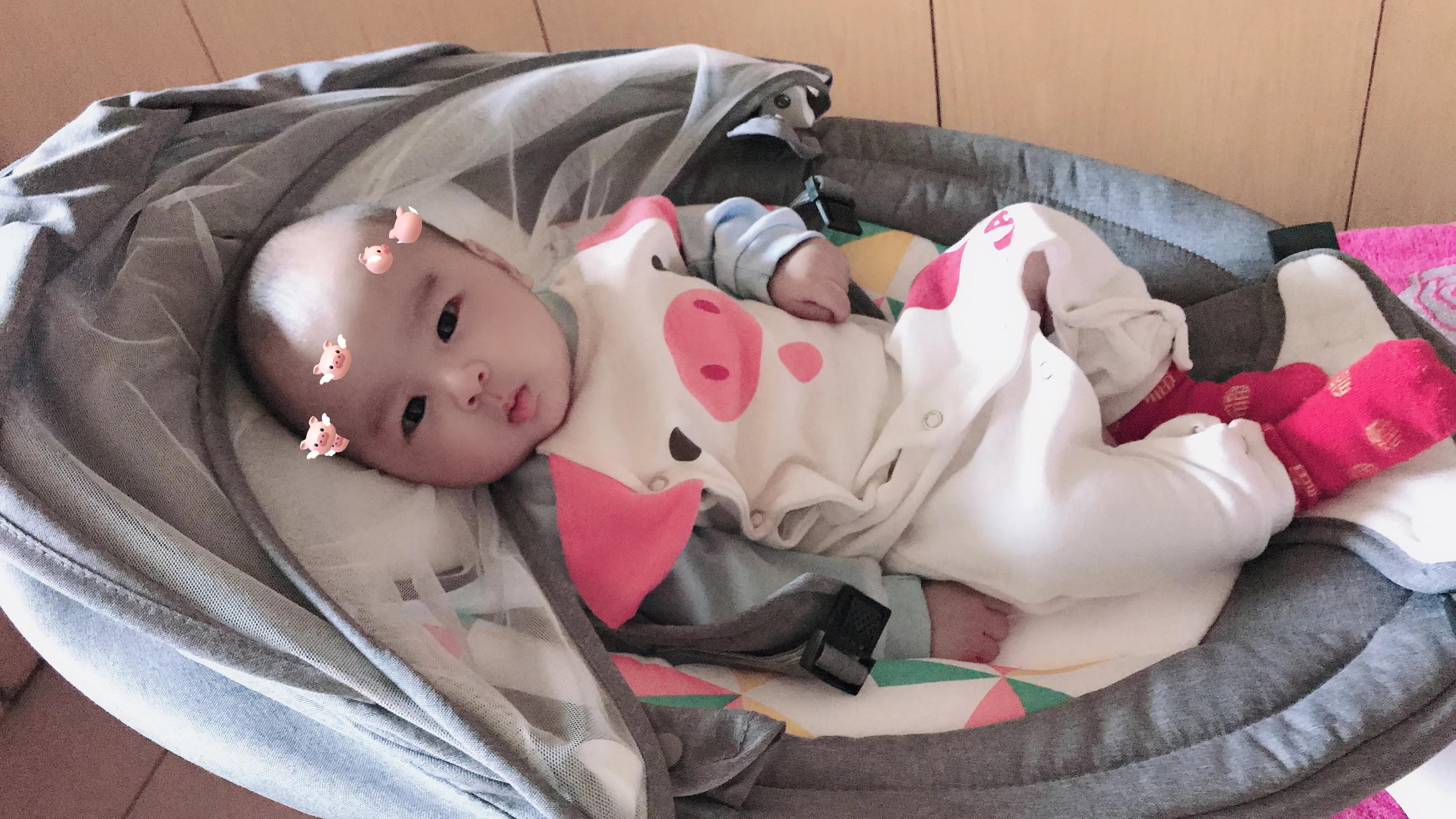 关于剖宫产的一些问题,剖宫产疤痕缺损的症状