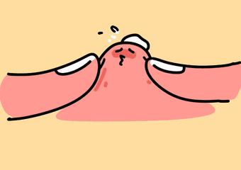 *血丝红**的自救指南,大家快来抄作业