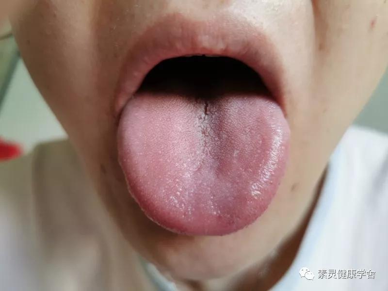 肝功检测异常,脐灸治疗肝脏视频