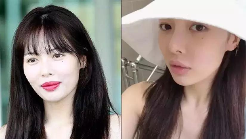 泫雅嘴唇前后对比,泫雅现在嘴唇好看吗