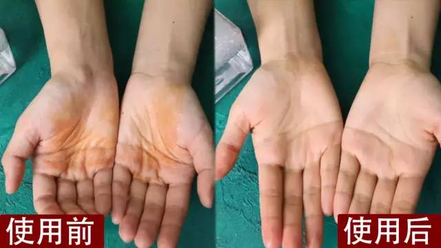 泡腾片洗手液除菌强么,除菌洗手液效果怎么样