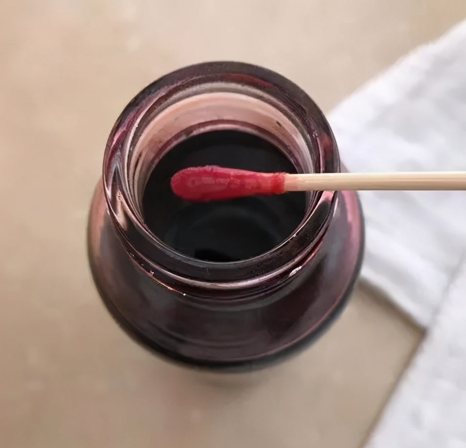 怎么治疗急性放射性皮炎,身上神经性皮炎很痒怎么办