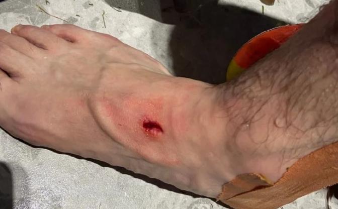 中超第五轮佳兆业,中超再现功夫