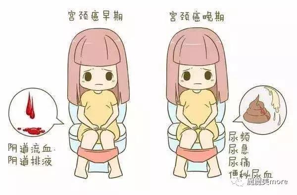 hpv宫颈癌育苗去哪里预约,hpv宫颈癌疫苗现场预约