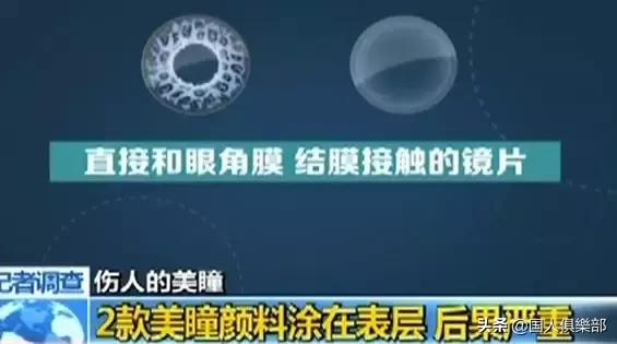 美瞳毁了一个女孩是真的吗,正在被美瞳毁掉的女孩们