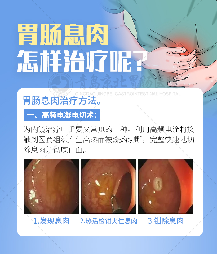 胃肠镜发现有息肉严重吗,肠镜多大息肉可内镜下切除