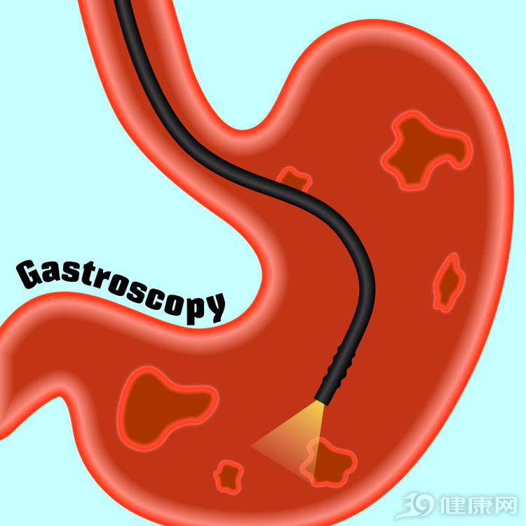 一般怎么才知道感染了幽门螺杆菌,幽门螺杆菌感染的十大误区