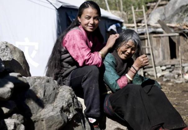 几十年前的农村几乎身上都有虱子,30年前的农村几乎人人都有虱子