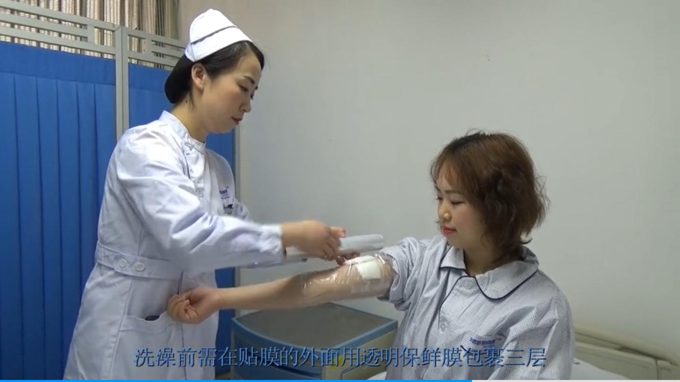 不可不知道的PICC置管后的居家护理