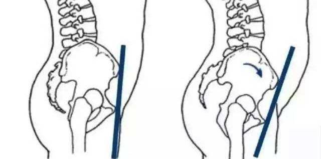 久坐腹股沟酸胀是怎么回事,久坐腹股沟疼痛的原因