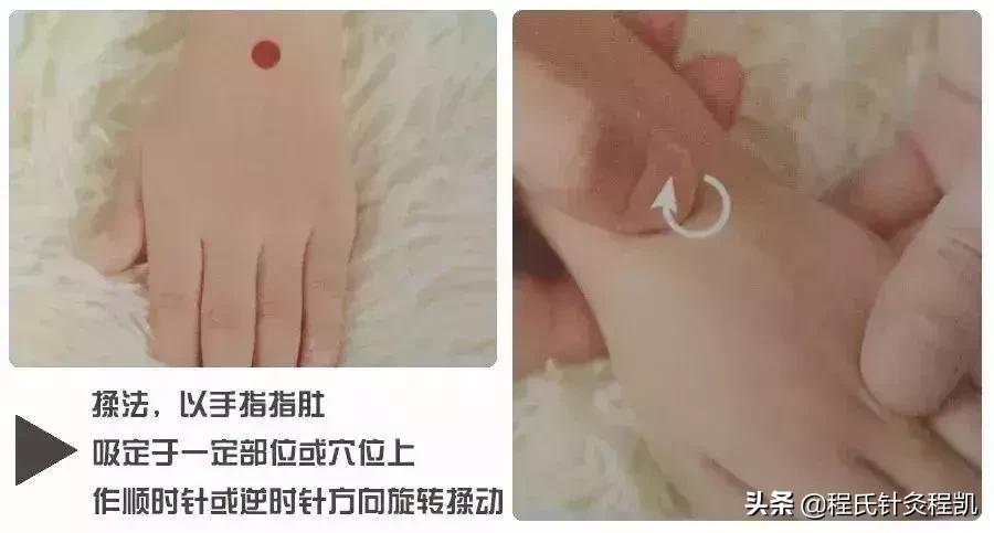 小儿荨麻疹中医反射推拿,荨麻疹夏季如何预防虫咬皮炎