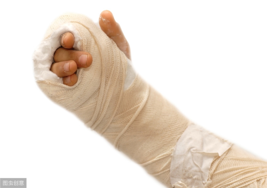 肘内翻矫正案例,肘内翻矫正会有后遗症吗