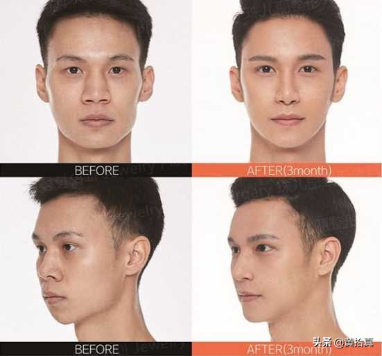 一个很丑的男生怎么改变自己,一个丑男人怎么变帅