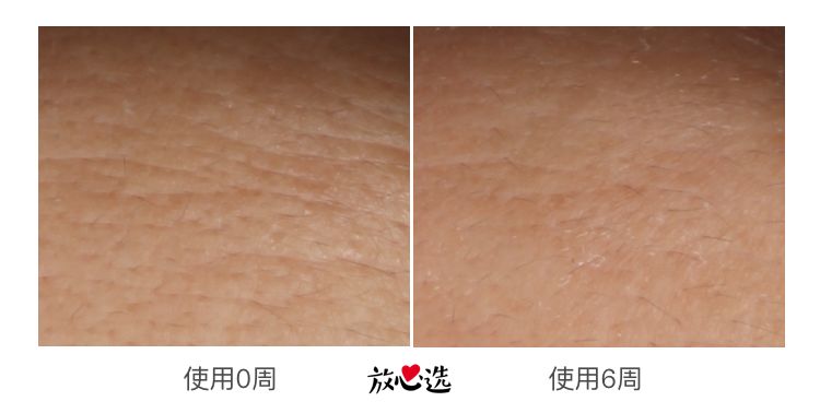 雅诗兰黛15毫升小棕瓶,雅诗兰黛小棕瓶精华100ml日上540元