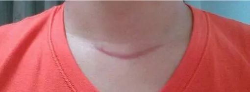 长治市第二人民医院激光手术,长治市第二人民医院外科