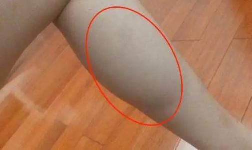 全部腿型改善方法,几种腿型分析