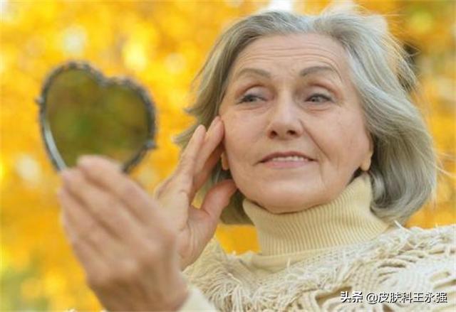 长了老年斑，有办法淡化吗？是否能彻底去除，皮肤科医生给你答案