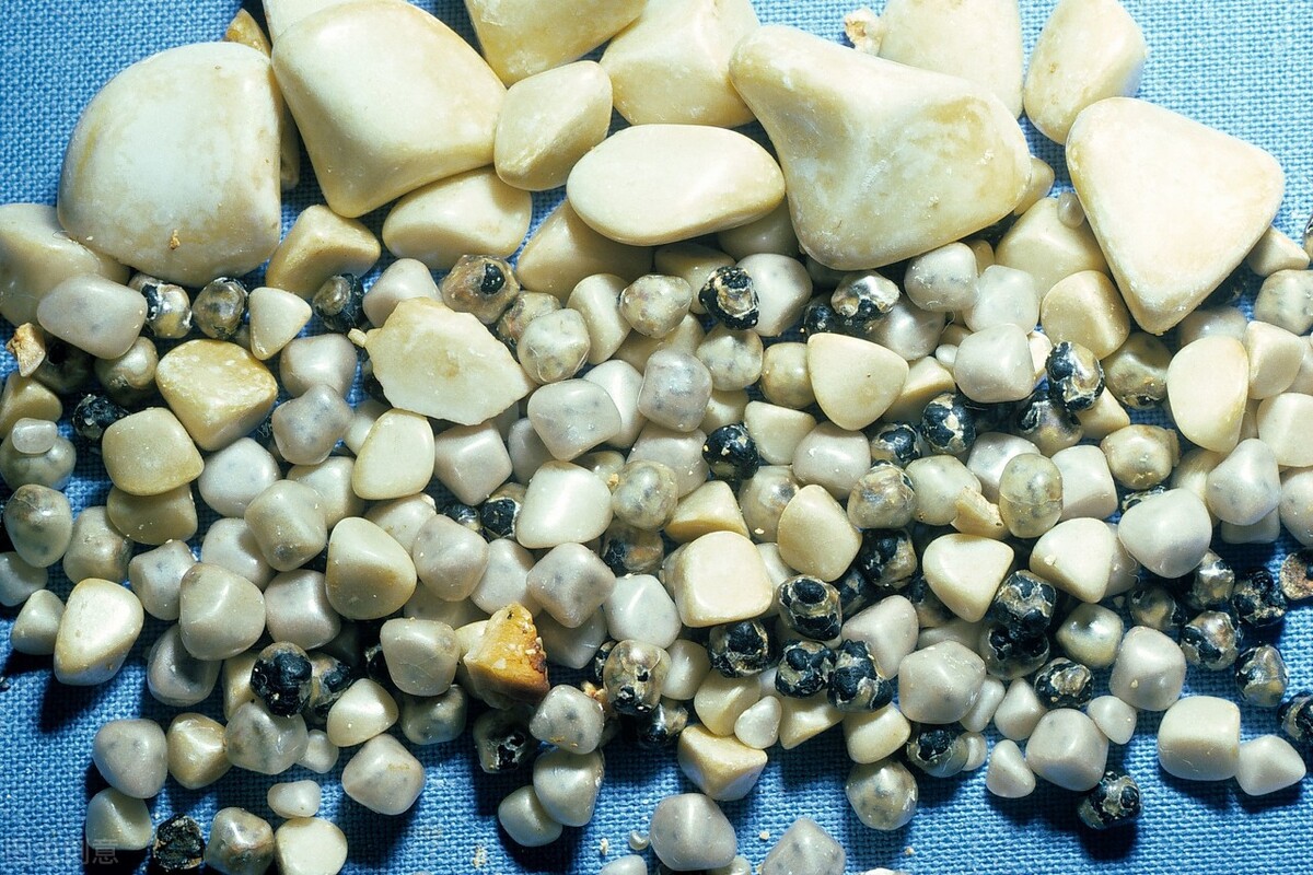 胆囊完全切除了对身体有哪些影响,胆囊重要但是不切不行